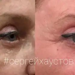 Пластичний хірург - Сергій Хаустов