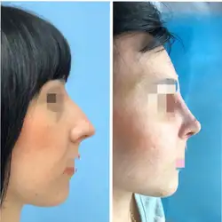Пластичний хірург Сергій Тижневий