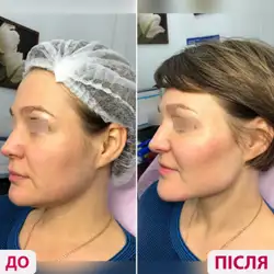 Лазерхауз - Миколаїв