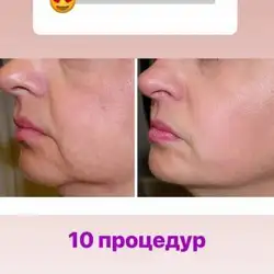 Інна Голубева