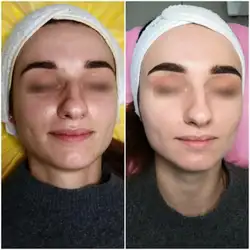 Ирина Мельник