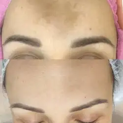 Peeling Bar