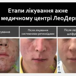 Леодерм - проспект Червоної Калини