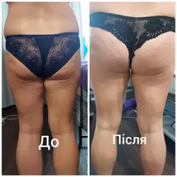 Олена Тарасова Масажист — Харків