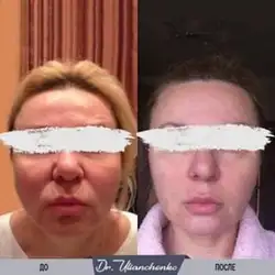 Наталія Ульянченко — Київ