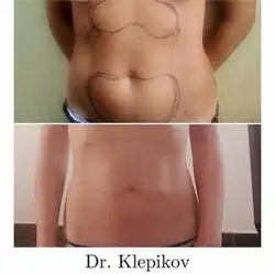 Сергій Клепіков