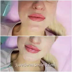 Альона Беспала