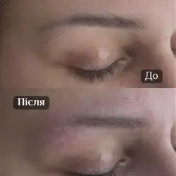 Лукач Анна