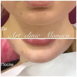 Art-clinic Monaco