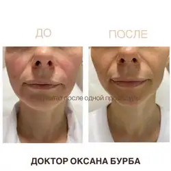 Оксана Бурба косметолог