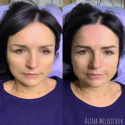 Аліна Мельничук