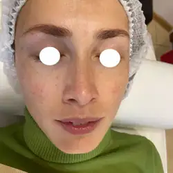 А2 care