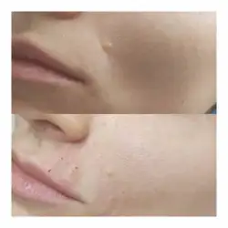 Анна Чуб