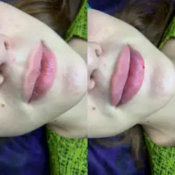 Алла Мальцева косметолог