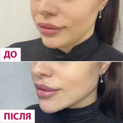Лазерхауз - Вишневе, Святошинська