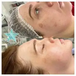 Dr. Irina Kravchuk