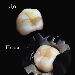 Надія Панчук