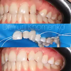 New Smile Studio