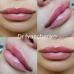 Аліна Іващенко — Киев