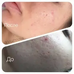 Олена Кружнова косметолог