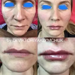 Вікторія Климчук косметолог
