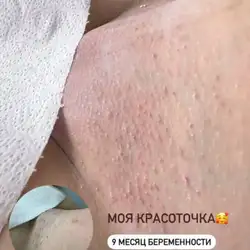 Анастасія Михайлик майстер депіляції