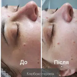Лариса Жижа