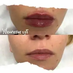 Анна Сизова Косметолог