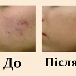Олена Макаревич Косметолог — Івано-Франківськ
