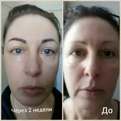 Олена Суботіна