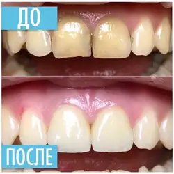 Владислав Іцкович