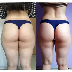 Just massage studio