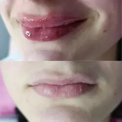 Inter derm