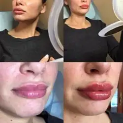 Наталія Чекалова — Київ