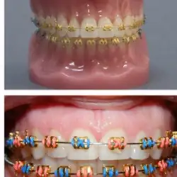 Nazaria Dental — Черкаси