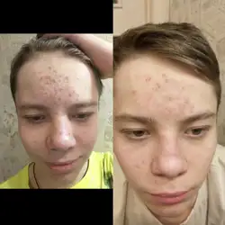 Марина Сушкова