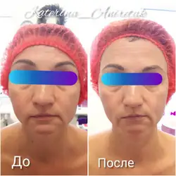 Katerina Aniretak косметолог