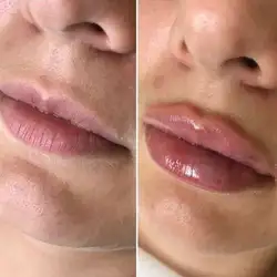 Юлія Петришена косметолог