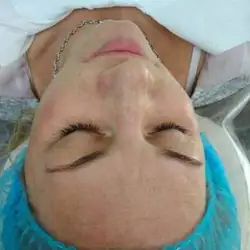 Оксана Жила косметолог