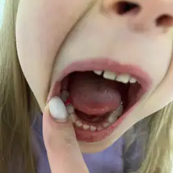 DENT103