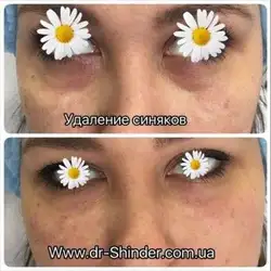 Аліна Шиндер