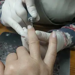 LAK