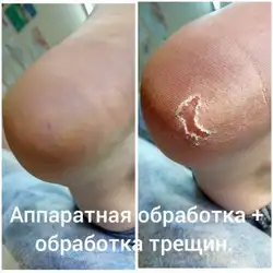 Веста Меладзе