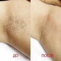 Віра Оранська Косметолог-естетист