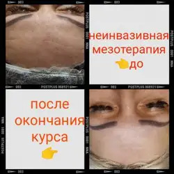 Лущевська Феріда